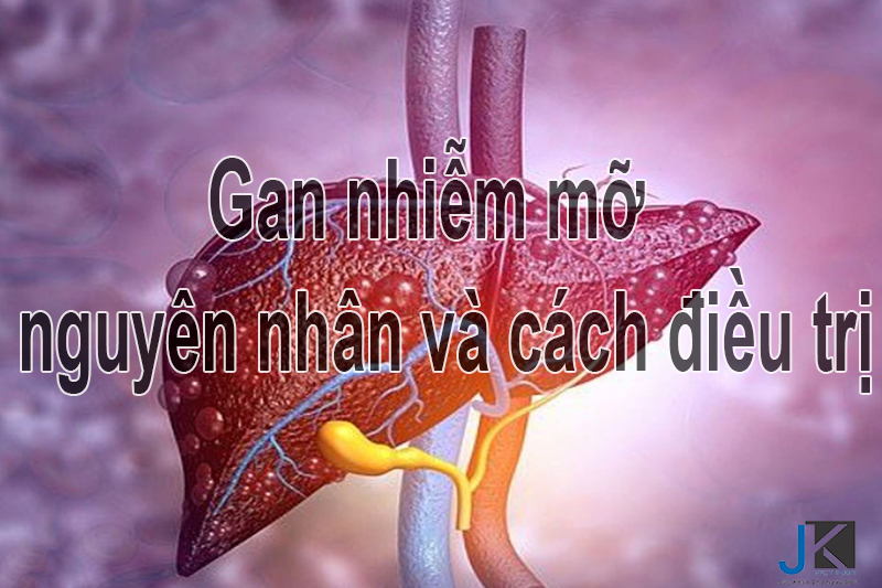 Gan nhiễm mỡ là gì? nguyên nhân cách điều trị