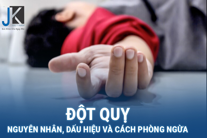 Dấu hiệu nhận biết đột quỵ